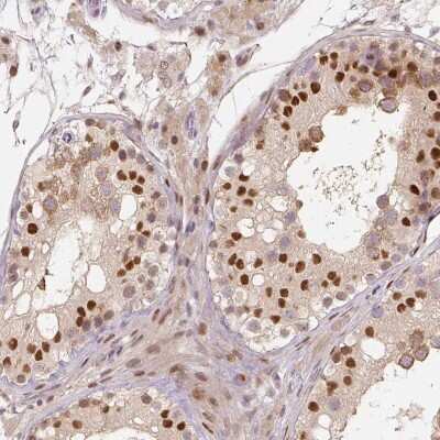 Immunohistochemistry-Paraffin: MUM1L1 Antibody [NBP1-81980]
