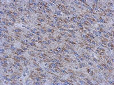 Immunohistochemistry-Paraffin: MUM1L1 Antibody [NBP2-19441]