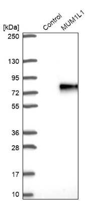 Western Blot: MUM1L1 Antibody [NBP1-81980]