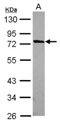 Western Blot: MUM1L1 Antibody [NBP2-19441]