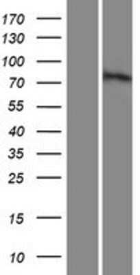 Western Blot: MUM1L1 Overexpression Lysate [NBP2-05370]