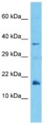 Western Blot: MUP-12 Antibody [NBP3-10123]