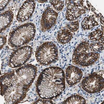 Immunohistochemistry-Paraffin: MUPP1 Antibody [NBP1-87839]