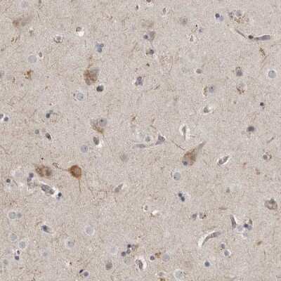 Immunohistochemistry-Paraffin: MUPP1 Antibody [NBP1-87840]