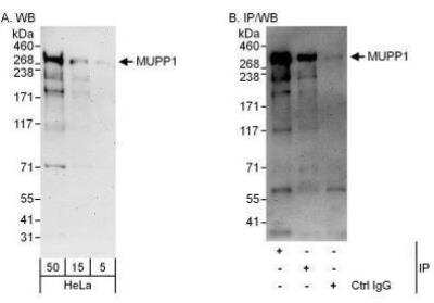 Western Blot: MUPP1 Antibody [NBP1-49974]