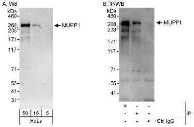 Western Blot: MUPP1 Antibody [NBP1-49975]