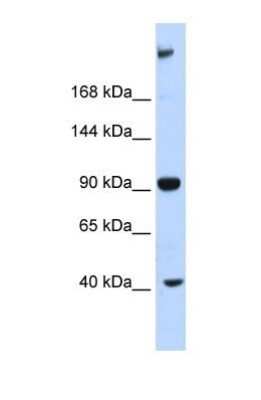 Western Blot: MUPP1 Antibody [NBP1-54331]