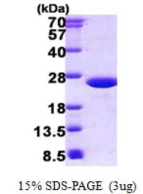 SDS-PAGE: Recombinant Mouse MUP-1 His Protein [NBP2-23212]