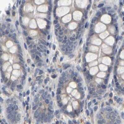 Immunohistochemistry-Paraffin: MURC Antibody [NBP1-86607]