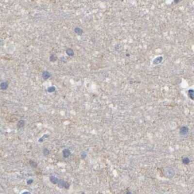 Immunohistochemistry-Paraffin: MURC Antibody [NBP1-86607]