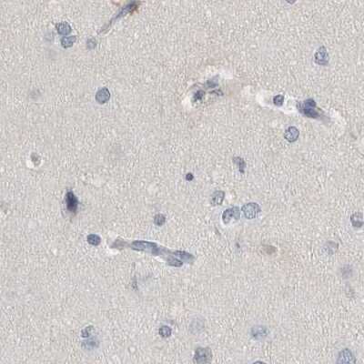 Immunohistochemistry-Paraffin: MURC Antibody [NBP1-86608]