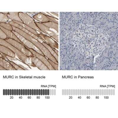 Immunohistochemistry-Paraffin: MURC Antibody [NBP1-86609]