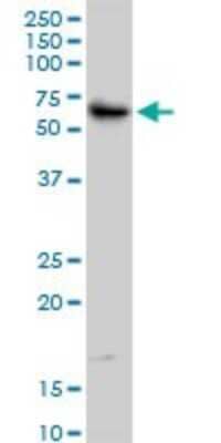 Western Blot: MURF2 Antibody (1A1) [H00084675-M02]