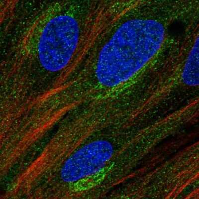 Immunocytochemistry/ Immunofluorescence: MURF2 Antibody [NBP2-33691]