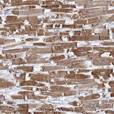 Immunohistochemistry-Paraffin: MURF2 Antibody [NBP1-92153]