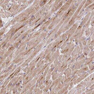 Immunohistochemistry-Paraffin: MURF2 Antibody [NBP2-33691]