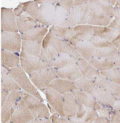 Immunohistochemistry-Paraffin: MURF2 Antibody [NBP2-33691]
