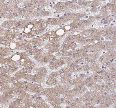 Immunohistochemistry-Paraffin: MURF2 Antibody [NBP2-33691]