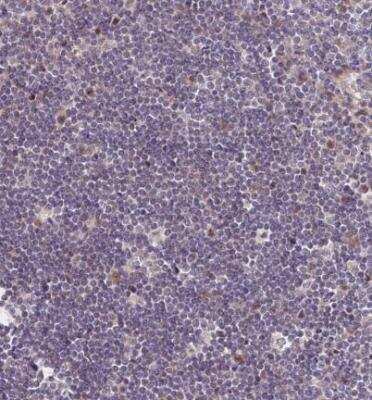 Immunohistochemistry-Paraffin: MURF2 Antibody [NBP2-33691]