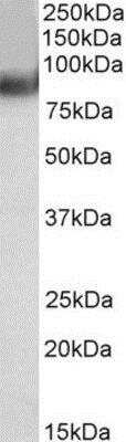 Western Blot: MURF2 Antibody [NB100-1196]