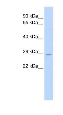 Western Blot: MURF2 Antibody [NBP1-55082]