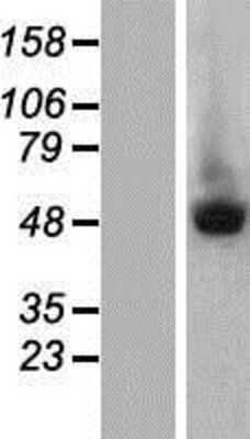 Western Blot: MURF2 Overexpression Lysate [NBP2-04773]