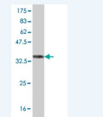 Western Blot: MURF3 Antibody (2G9) [H00057159-M02]