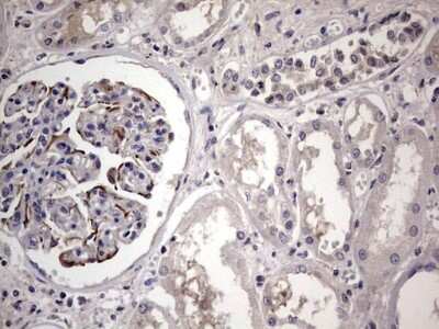 Immunohistochemistry: MURF3 Antibody (OTI7F8) [NBP2-46224]