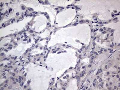 Immunohistochemistry: MURF3 Antibody (OTI7F8) [NBP2-46224]