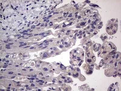 Immunohistochemistry: MURF3 Antibody (OTI7F8) [NBP2-46224]