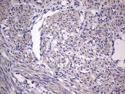 Immunohistochemistry: MURF3 Antibody (OTI7F8) [NBP2-46224]