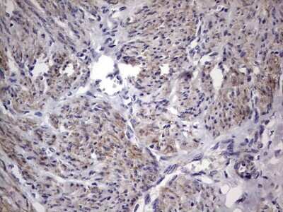 Immunohistochemistry: MURF3 Antibody (OTI7F8) [NBP2-46224]