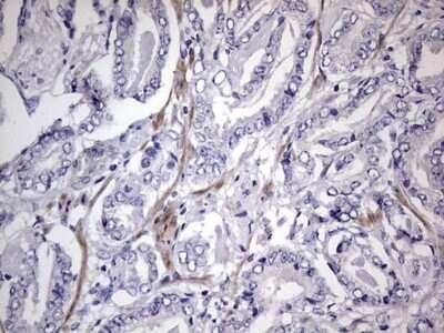 Immunohistochemistry: MURF3 Antibody (OTI7F8) [NBP2-46224]