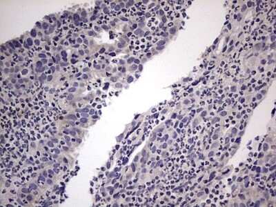 Immunohistochemistry: MURF3 Antibody (OTI7F8) [NBP2-46224]