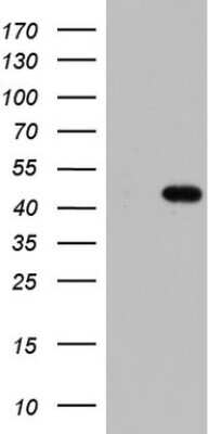 Western Blot: MURF3 Antibody (OTI7F8) [NBP2-46224]