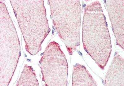 Immunohistochemistry-Paraffin: MURF3 Antibody [NB100-1197]