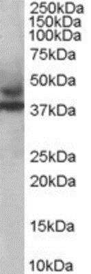 Western Blot: MURF3 Antibody [NB100-1197]