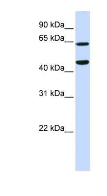 Western Blot: MURF3 Antibody [NBP1-52899]