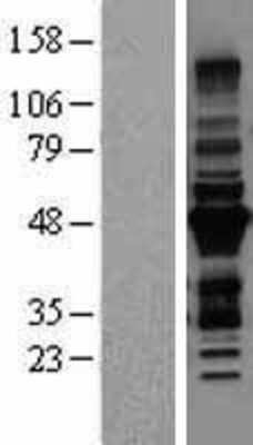 Western Blot: MURF3 Overexpression Lysate [NBL1-17305]