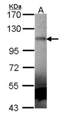 Western Blot: MuSK Antibody [NBP2-15028]