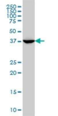 Western Blot: MVD Antibody (2A7) [H00004597-M01]