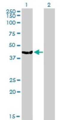 Western Blot: MVD Antibody (2A7) [H00004597-M01]