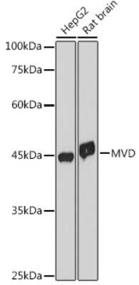 Western Blot: MVD Antibody (7G4B9) [NBP3-15308]