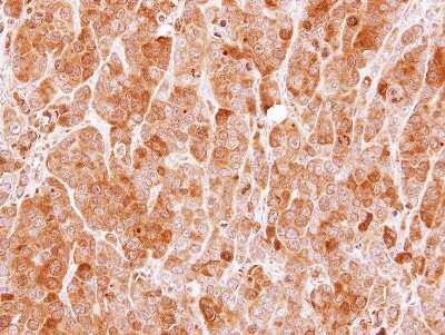 Immunohistochemistry-Paraffin: MVD Antibody [NBP1-33050]