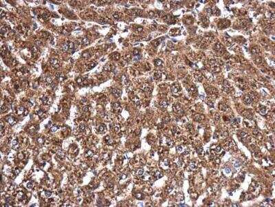 Immunohistochemistry-Paraffin: MVD Antibody [NBP1-33127]