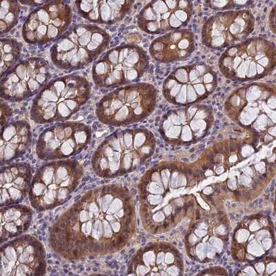 Immunohistochemistry-Paraffin: MVD Antibody [NBP2-13628]