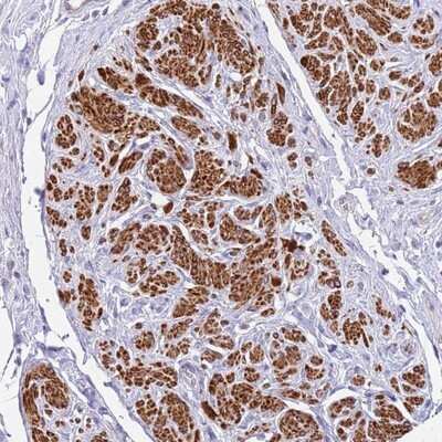 Immunohistochemistry-Paraffin: MVD Antibody [NBP2-13629]