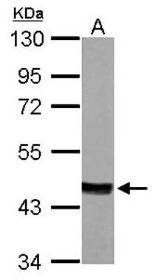 Western Blot: MVD Antibody [NBP1-33050]