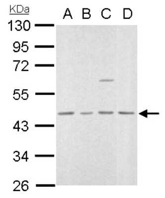 Western Blot: MVD Antibody [NBP1-33050]