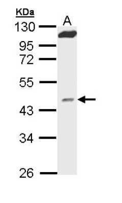 Western Blot: MVD Antibody [NBP1-33127]